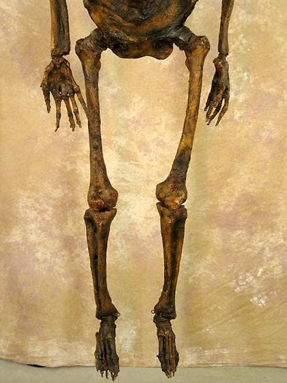 Life- Size Rotted Skeleton